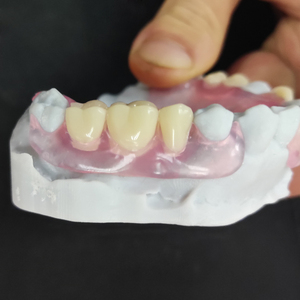 Riduzione minima dei denti miglior prezzo protesi flessibile <span class=keywords><strong>Valplast</strong></span> rimovibile con falsi denti acrilici artificiali - Product Image 1