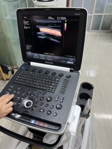 HM70A <b>Portable</b> <b>Ultrasound</b> <b>Machine</b> Competitive price ,worldwide shipping,5 Years warranty - Product Image 2