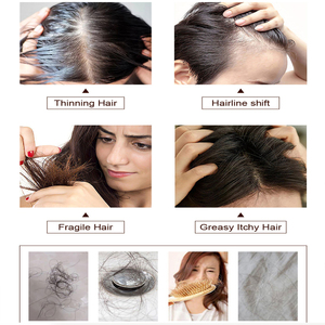 Champú y Acondicionador para <span class=keywords><strong>el</strong></span> Cuidado del Cabello Graso de Marca Privada, Aceite para <span class=keywords><strong>el</strong></span> Crecimiento del Cabello con Biotina y Arginina para Prevenir la Caída y Humectar <span class=keywords><strong>el</strong></span> Cabello en Casa - Product Image 3