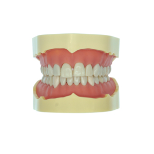 Nha khoa Modle tiêu chuẩn cho nghiên cứu nha khoa mô hình giáo dục học sinh nha khoa - Product Image 3