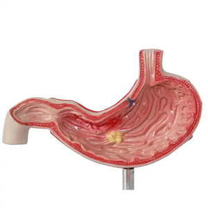 Equipo de enseñanza médica, ciencia médica, modelo de órgano humano patológico gástrico, modelo de anatomía, modelo de estómago - Product Image 4