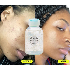 El suero facial de etiqueta privada proporciona humedad mejora el brillo amarillo oscuro elimina las manchas oscuras obstruye la producción de melanina - Product Image 1