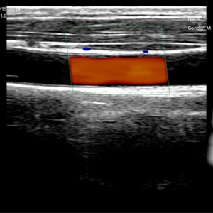 Sonde d'échographie portable sans fil, scanner à ultrasons portable, sonde double convexe/cardiaque/ligneaire 3 en 1 pour téléphone portable DCU19E - Product Image 5