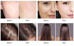 جهاز الوجه المحمول الممتاز بالأكسجين والماء 7 في 1 لإزالة الجلد الحقن في الوجه لعلاج البشرة - Product Image 5