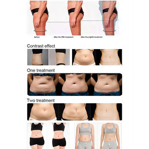 Kunden spezifische Pump massage Fuß Bein Luftdruck massage gerät Luft kompression Sport Erholung Luft wiederherstellung Stiefel Presso therapie Anzug - Product Image 5