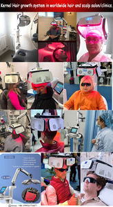 Appareil de thérapie laser LLLT médical professionnel pour les cliniques de dermatologie pour l'alopécie androgénétique et <span class=keywords><strong>la</strong></span> perte de cheveux post-partum - Product Image 5