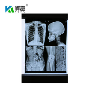 Pellicola Radiografica Termica Blu Personalizzata per Imaging a Secco, Base Blu per Toner <span class=keywords><strong>Laser</strong></span> Medico - Product Image 4
