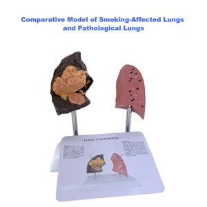 Modelo comparativo para pulmón <span class=keywords><strong>de</strong></span> <span class=keywords><strong>fumador</strong></span> vs equipo educativo <span class=keywords><strong>de</strong></span> pulmón normal - Product Image 4
