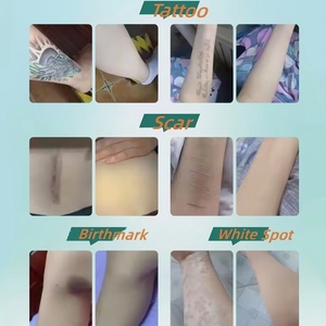 Cinta Adhesiva Semitransparente para Disimular Tatuajes en el <span class=keywords><strong>Brazo</strong></span>, 4cm X 150cm, Rollo <span class=keywords><strong>de</strong></span> Aplicación Rápida, Se Aceptan Pedidos <span class=keywords><strong>de</strong></span> Prueba - Product Image 3