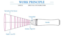 Appareil de thérapie par ondes de choc extracorporelles radiales focalisées portable professionnel pour le soulagement de la douleur et la régénération des tissus - Product Image 3