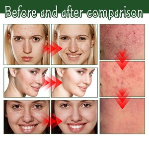 Crème <span class=keywords><strong>pour</strong></span> le visage South Moon Collagen Vitamine <span class=keywords><strong>hydratante</strong></span> anti-âge, anti-acné et anti-taches, éclaircissante et correctrice - Product Image 6