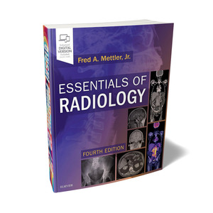 Elementi Essenziali di Radiologia 4a Edizione, Libro di Testo Medico con Copertina Morbida, Stampa Personalizzata con Rilegatura Perfetta - Product Image 1