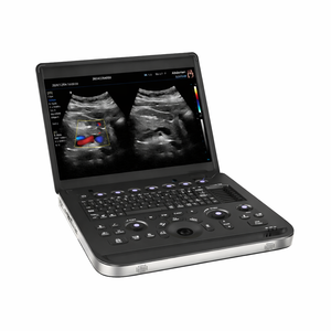 Échographe vétérinaire portable pour clinique hospitalière, fabrication <span class=keywords><strong>d</strong></span>'échographes, échocardiographe 3D couleur Doppler - Product Image 2
