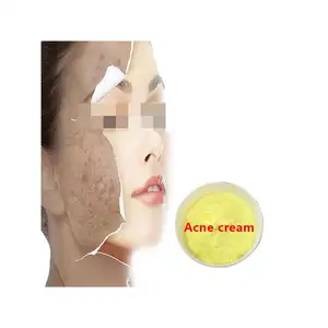 Moi Thu Ban Can Deu O Day Tea Tree Oil Acne Removing Acne Treatment Pimple Scar Removal Anti Acne Cream
