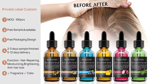 Minyak penumbuh rambut Rosemary perawatan organik Logo pribadi minyak pohon teh kastor Argan kolagen Peppermint - Product Image 2