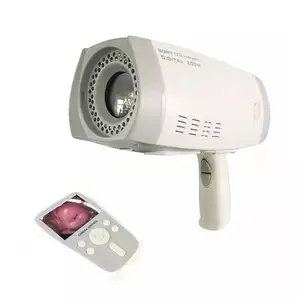 Мини Портативный эндоскоп цифровой вагинальный расширитель камера кольпоскоп камера для гинекологии
