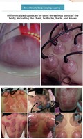 Masseur de poitrine infrarouge 4-en-1 avec vibrations et pression négative, instrument de massage électrique multi-modes pour les seins
