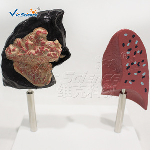 Modèle comparative des poumons normaux et des poumons de fumeurs, utilisé pour la démonstration, l'enseignement et la vulgarisation des lésions pulmonaires. - Product Image 4