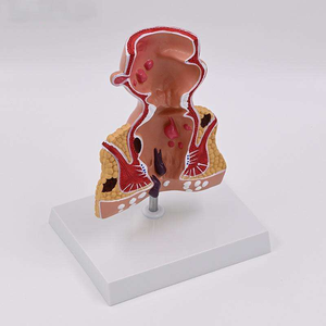 Modèle anatomique pathologique rectal en PVC pour la démonstration pédagogique en sciences médicales dans les universités médicales et les hôpitaux - Product Image 4