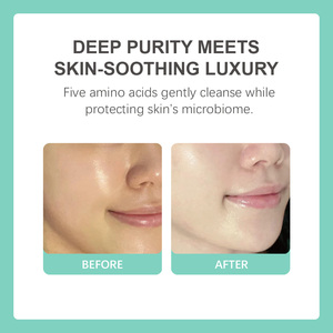Gel limpiador facial refrescante: crea espuma ligera para limpiar las impurezas, calma la piel después del lavado, controla la secreción <span class=keywords><strong>de</strong></span> aceite - Product Image 4