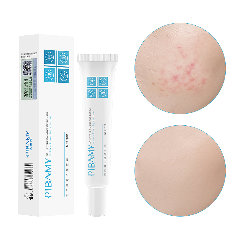 Wholesale PIBAMY treatment scars acne natural whitening skin marks remove acne cream for face