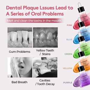 Siero per Denti Naturale a Marchio Privato, Rinfresca l'Alito, Sbianca i Denti, Protegge i Denti, Essenza Orale Profumata per la Cura Dentale - Product Image 5