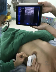 C37A Kliniek Binnen/Buiten Handheld Kleuren 7,5 & 10MHz 128 Elementen Draagbaar Lineair Apparaat voor Vascular Doppler Onderzoeken - Product Image 5