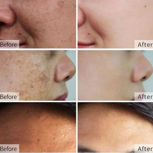 كريم ولوشن متطور لتفتيح وترطيب البشرة بتصنيع المعدات الأصلية للوجه والجسم ومنطقة البكيني وداخل الفخذين ومصحح للبقع الداكنة والتصبغات - Product Image 4