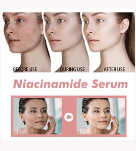 Peach 70 Niacinamide huyết thanh 30ml Hàn Quốc đốm đen Corrector làm trắng sáng dưỡng ẩm mặt chăm sóc da mặt huyết thanh trên khuôn mặt cho khuôn mặt - Product Image 3