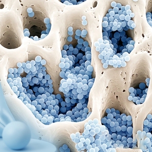 Sérum dentaire à l'hydroxyapatite nano, marque privée, blanchiment des dents, réparation de l'émail, soin buccal avec <span class=keywords><strong>acide</strong></span> <span class=keywords><strong>hyaluronique</strong></span> et xylitol - Product Image 2