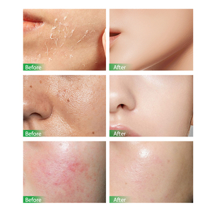 Vente en gros Masque <span class=keywords><strong>visage</strong></span> cactus 5 <span class=keywords><strong>feuilles</strong></span> 30g chacune purifie et matifie en profondeur la peau sans brillance - Product Image 4
