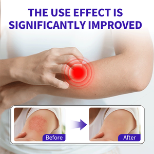 Parche Herbal Profesional Antifúngico para Eccema - Bacteriostático, Alivia la Picazón y la Descamación en Dermatitis, Psoriasis e <span class=keywords><strong>Infecciones</strong></span> de la Piel - Product Image 2