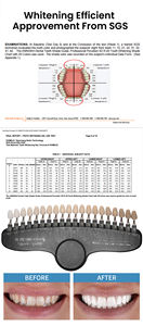 <span class=keywords><strong>Gel</strong></span> pemutih gigi cepat secara efektif menghilangkan noda kuning dan perubahan warna. Mengandung 35% karbamade peroksida. Portabel. - Product Image 6