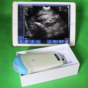 Scanner de balayage de ventilateur mécanique portable pour instrument vétérinaire à ultrasons vétérinaire - Product Image 6