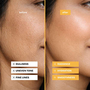 Savon anti-âge naturel au curcuma, au lait de riz et à l'huile d'olive pour une peau éclatante et jeune - Product Image 2