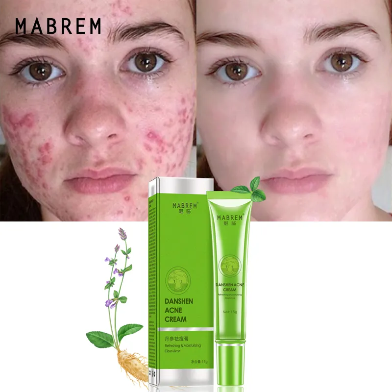 Mabrem Danshen Acne Crème Hydraterende Kalmerende Spieren Verbetert Huid Drynessroughnessreduces Poriën 15G