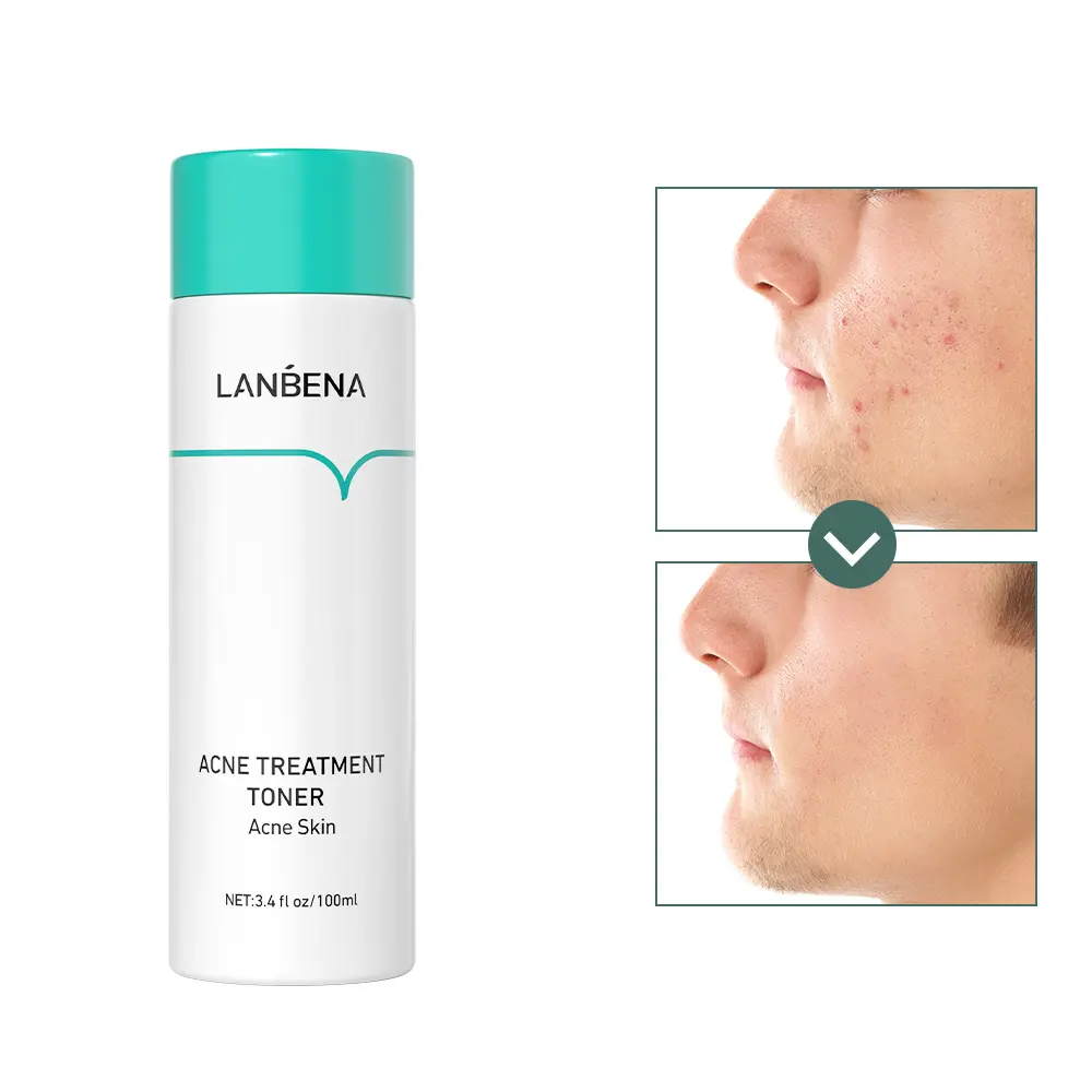 LANBENA-tóner facial de marca privada, oligóptido, antiacné, hidratante, líneas finas suaves