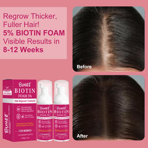 Oem Vente en gros Solution topique pour hommes contre <span class=keywords><strong>la</strong></span> chute de cheveux Traitement pour <span class=keywords><strong>la</strong></span> repousse des cheveux Sérum pour le cuir chevelu Mousse pour <span class=keywords><strong>la</strong></span> croissance des cheveux à <span class=keywords><strong>la</strong></span> biotine - Product Image 6