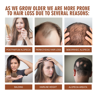 Krim Rambut Batana Label Pribadi, Nutrisi Mendalam dan Perbaikan Rambut, Mengurangi Kerontokan Rambut untuk Semua Jenis Rambut