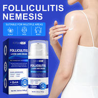 Crema ATOANY Quick Comfort & Renewal para el Cuidado de la Foliculitis y el Acné con 1% de Ácido Salicílico + Extractos Herbales para Cuero Cabelludo, Rostro, Cuerpo y Piel