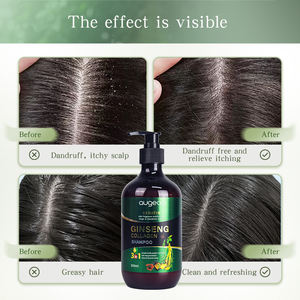 แชมพูสมุนไพรธรรมชาติขิงป้องกันผมร่วงป้องกันรังแคแชมพูบำรุงเส้นผมโสม - Product Image 6