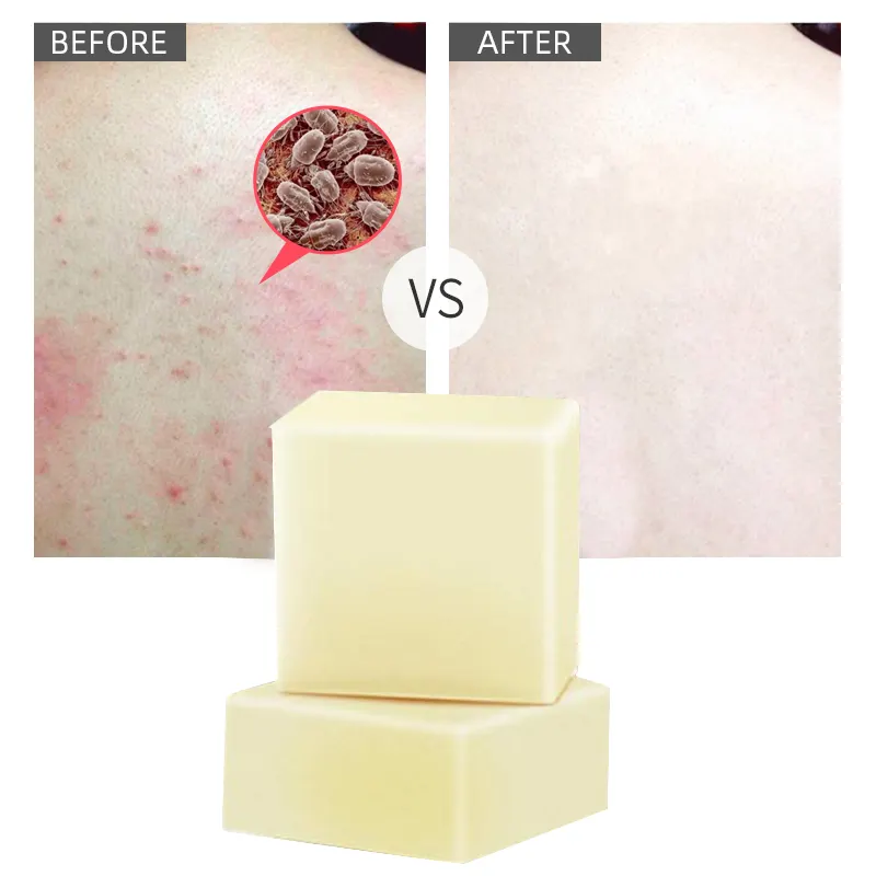Premium 100% Natural Organic Face Body Whitening Handmade Skin Acne Deep Cleansing Face Care Sea Salt Soap Goat Milk Soap