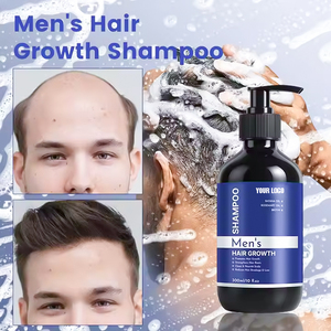 Champú para pérdida de cabello fortalecedor <span class=keywords><strong>sin</strong></span> sulfato de etiqueta privada personalizada Champú anticrecimiento con características suavizantes y refrescantes - Product Image 3