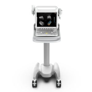 Ecógrafo 3D de 15 Pulgadas para Embarazo, Máquina de Ultrasonido Veterinario, Ecógrafo Doppler Color para Hospital de Cardiología - Product Image 3