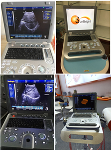 Equipo Portátil de Ultrasonido Veterinario Sunbright SUN-<span class=keywords><strong>800D</strong></span>, Escáner de Ultrasonido en Blanco y Negro - Product Image 2