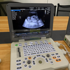 Vente Doppler Chien <span class=keywords><strong>Grossesse</strong></span> Scanner Diagnostic Échographie Animal Chèvre Echo Sonar Portable Échographie Machine - Product Image 5