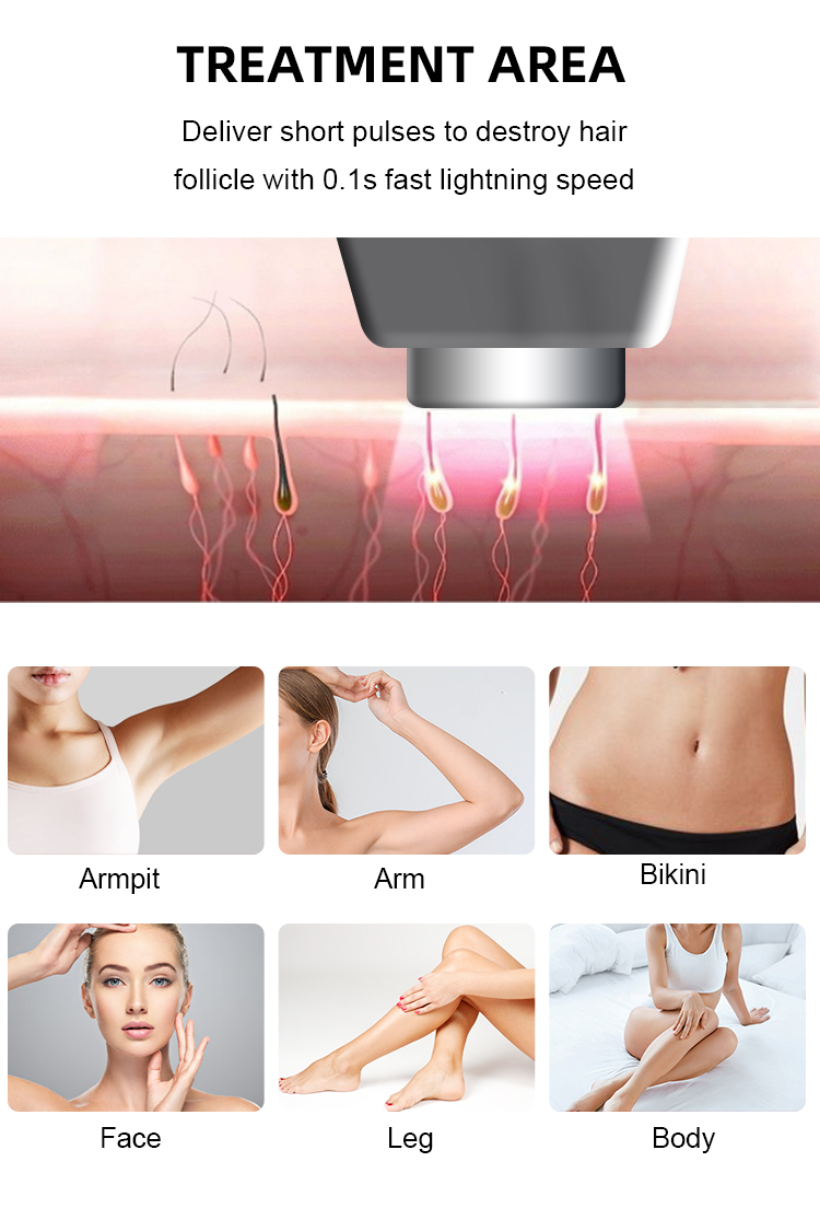 New Technology Fiber Laser Hair Removal Machine 50 Million Lifespan