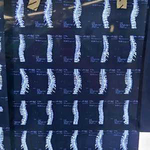 Surveillance neurophysiologique du système de neuromonitoring peropératoire (PIOM) à 32 canaux tubes endotrachéaux EMG - Product Image 6