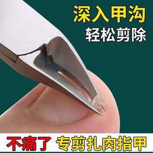 ที่ตัดเล็บเท้าสำหรับเล็บขบ ขนาด 12.5 มม. รูปทรงเฉียง ทำจากสแตนเลส ชุดตัดเล็บและตัดหนังกำพร้า - Product Image 5