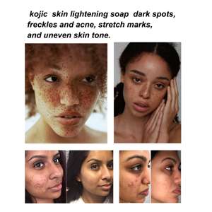 Roishun sabun cuci wajah, sabun pencuci wajah pemutih asam Kojic pemutih Label pribadi - Product Image 2